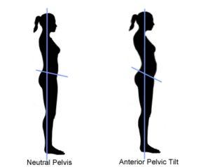 pelvictilt